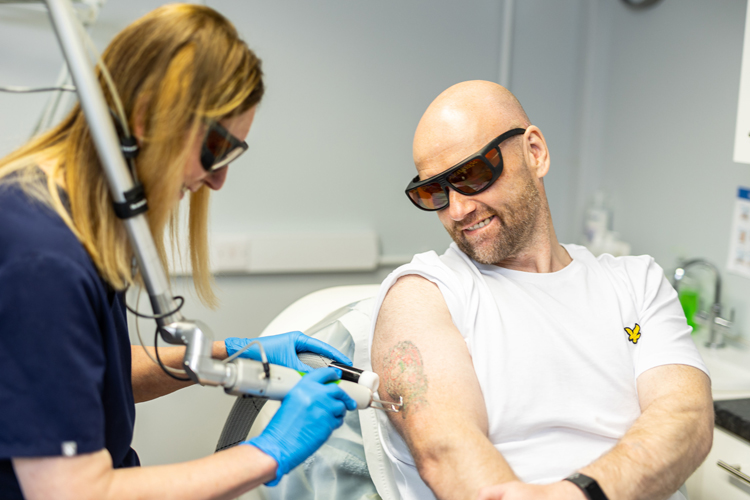 Tattoo removal