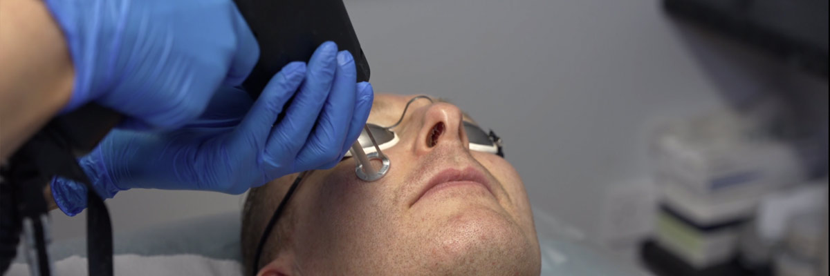 ResurFACE Fractional Laser