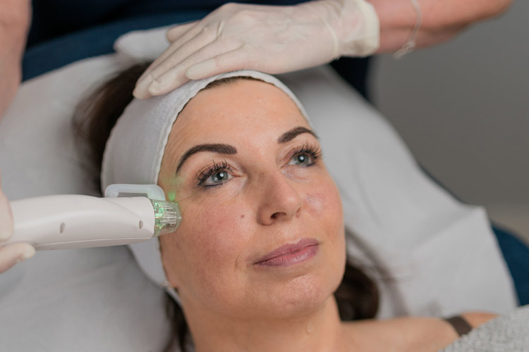 Skin Rejuvenation and Tightening