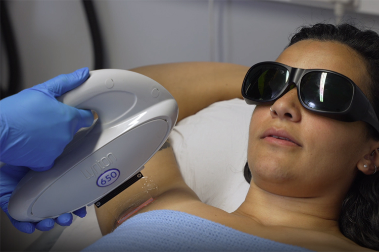 Light assisted hair removal