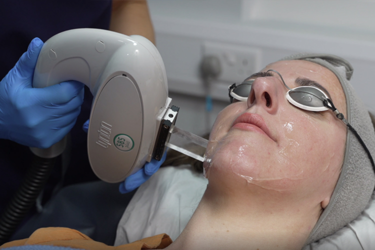 IPL Skin Rejuvenation