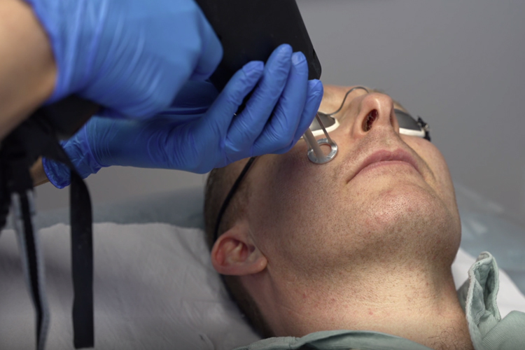 ResurFACE Fractional Laser