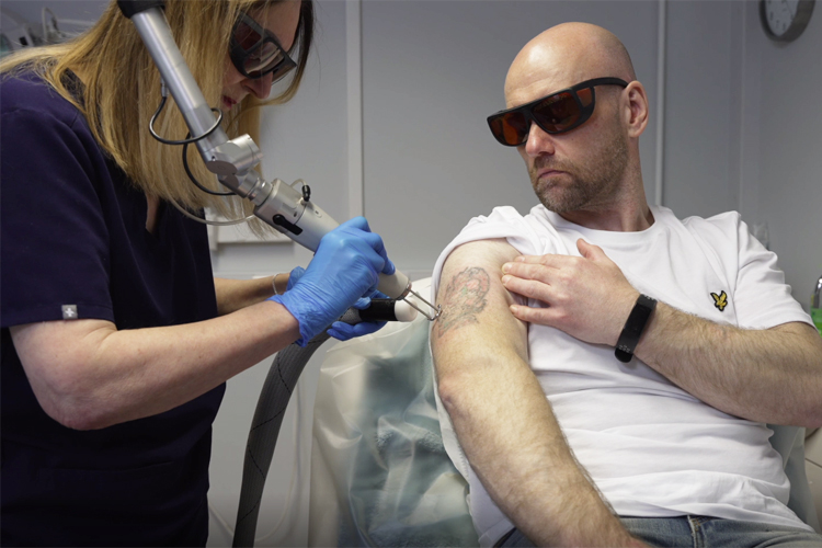 Tattoo Removal Q plus C